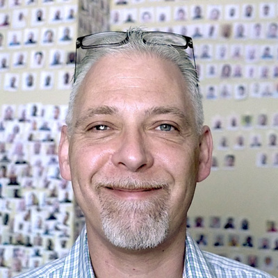 "My scars make me beautiful" - Jeremy's Story "My scars make me beautiful" - Jeremy's Story