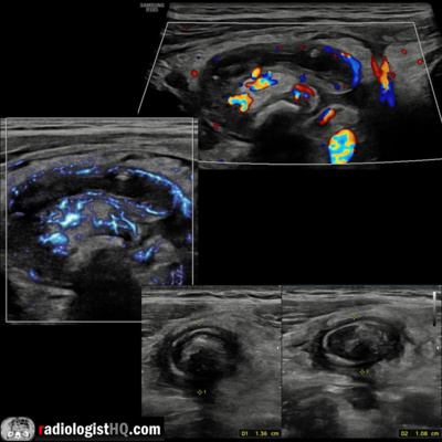 Radiology Lectures | Radquarters