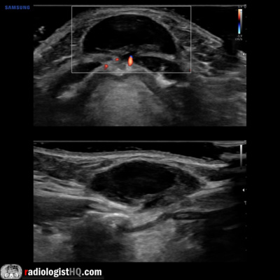 Radiology Lectures | Radquarters