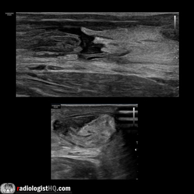 Radiology Lectures | Radquarters
