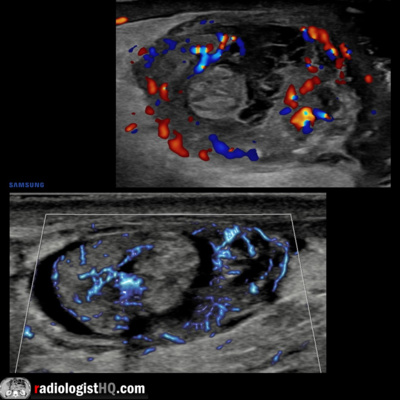 Radiology Lectures | Radquarters