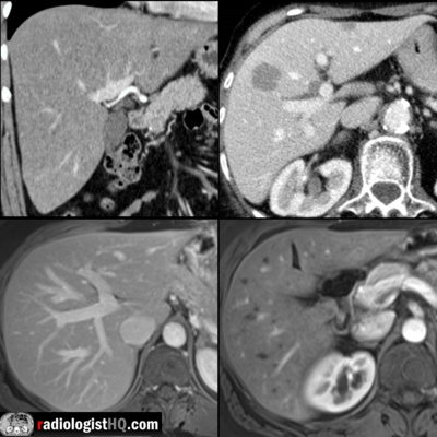 Radiology Lectures | Radquarters