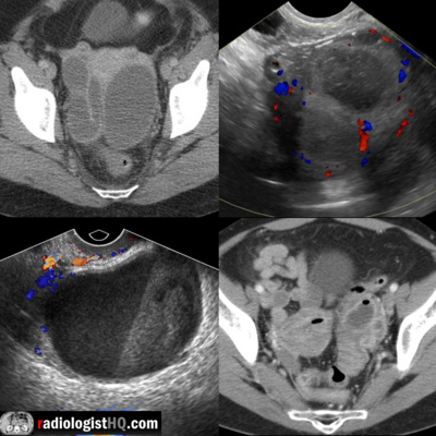 Radiology Lectures | Radquarters