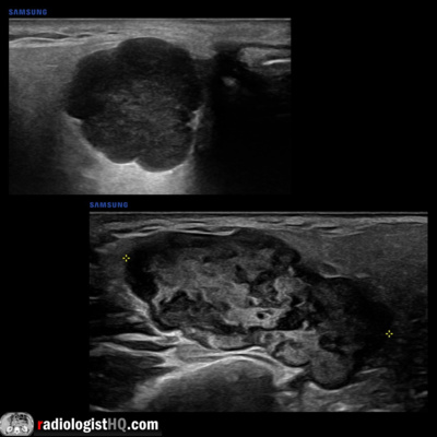 Radiology Lectures | Radquarters