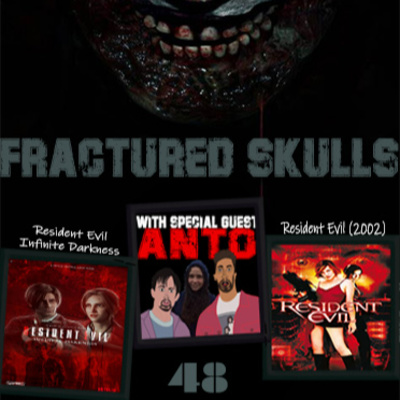 Fractured Skulls