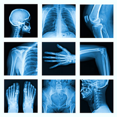 X-Rays episode artwork
