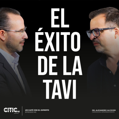 Un café con el experto