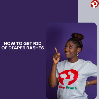 Diaper Rash in Babies