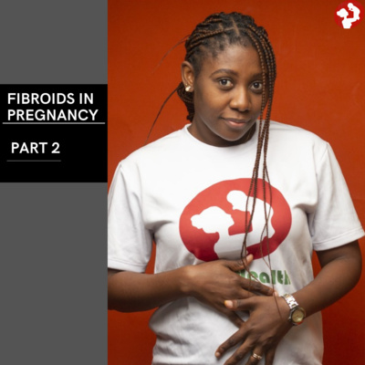 Fibroids in Pregnancy (2)