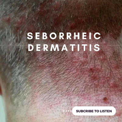 Seborrheic Dermatitis