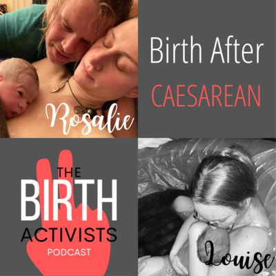 S2 E13: Birth After Caesarean