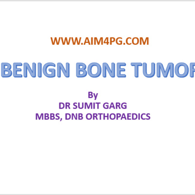 BENIGN BONE TUMORS