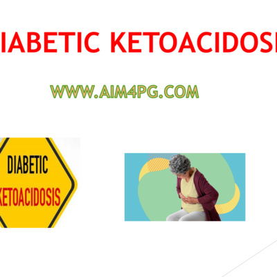 MANAGEMENT OF DIABETIC KETOACIDOSIS