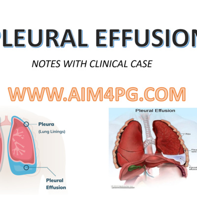 PLEURAL EFFUSION WITH NOTES & CLINICAL CASE