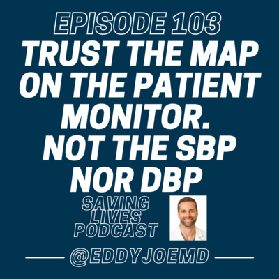 Trust the MAP on the Patient Monitor. Not the SBP nor DBP on Patients with a BP Cuff