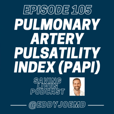 Pulmonary Artery Pulsatility Index (PAPi)