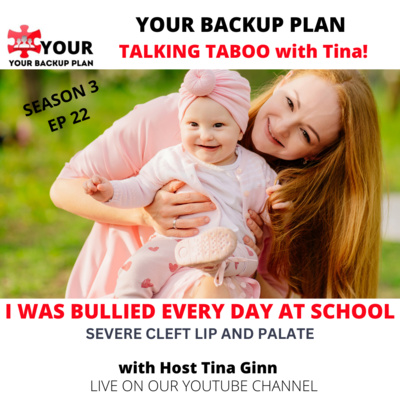 I WAS BULLIED EVERY DAY AT SCHOOL - Severe Cleft Lip and Palate