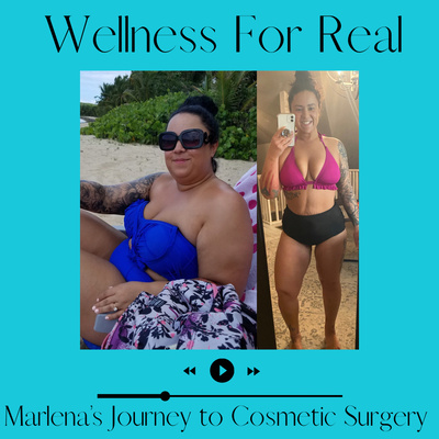 Marlena's Journey to Cosmetic Surgery