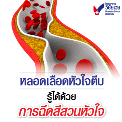 รู้ทันปัญหาสุขภาพ โดย โรงพยาบาลวิชัยเวชฯ หนองแขม