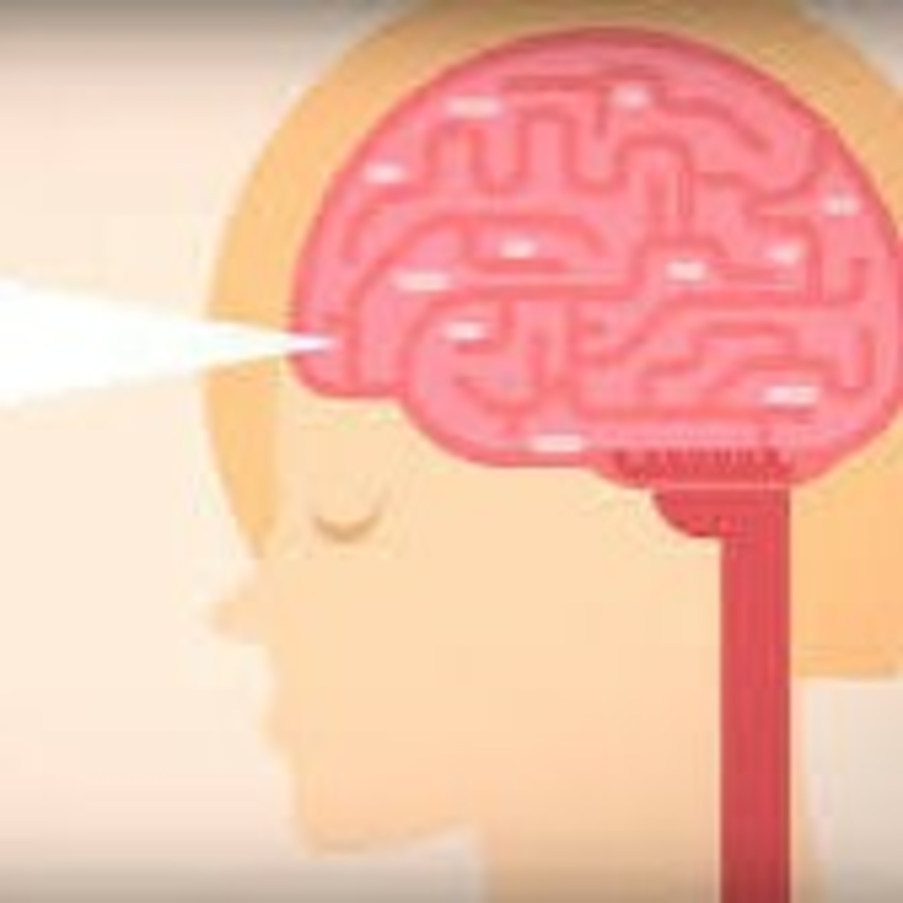 Diarrea Viral Y Bacteriana 