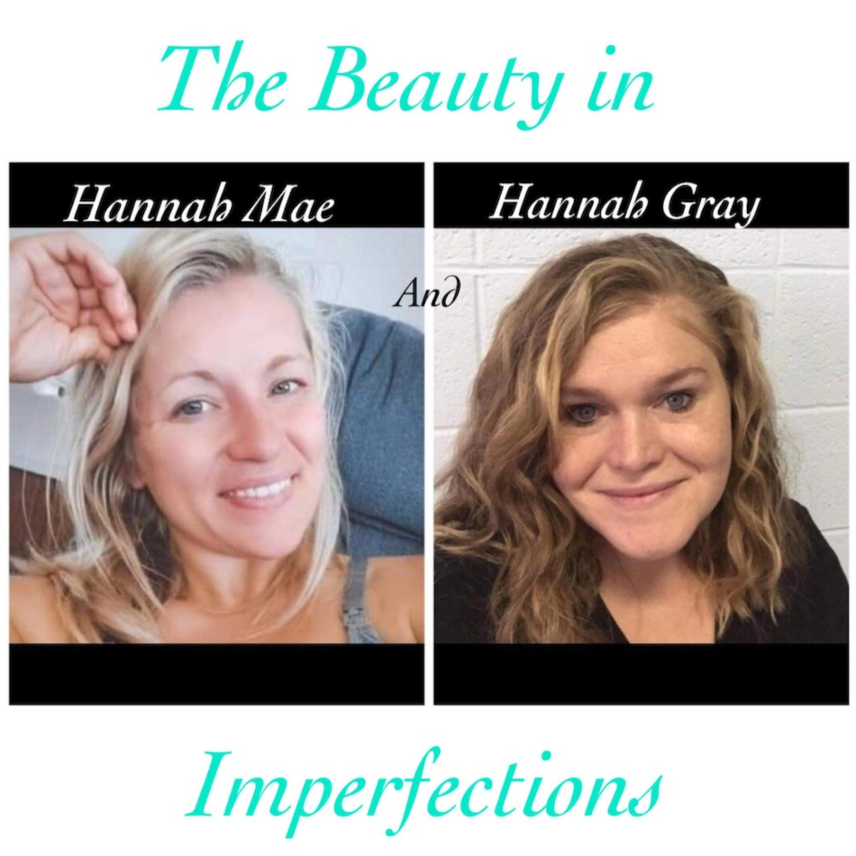 The Beauty in Imperfections