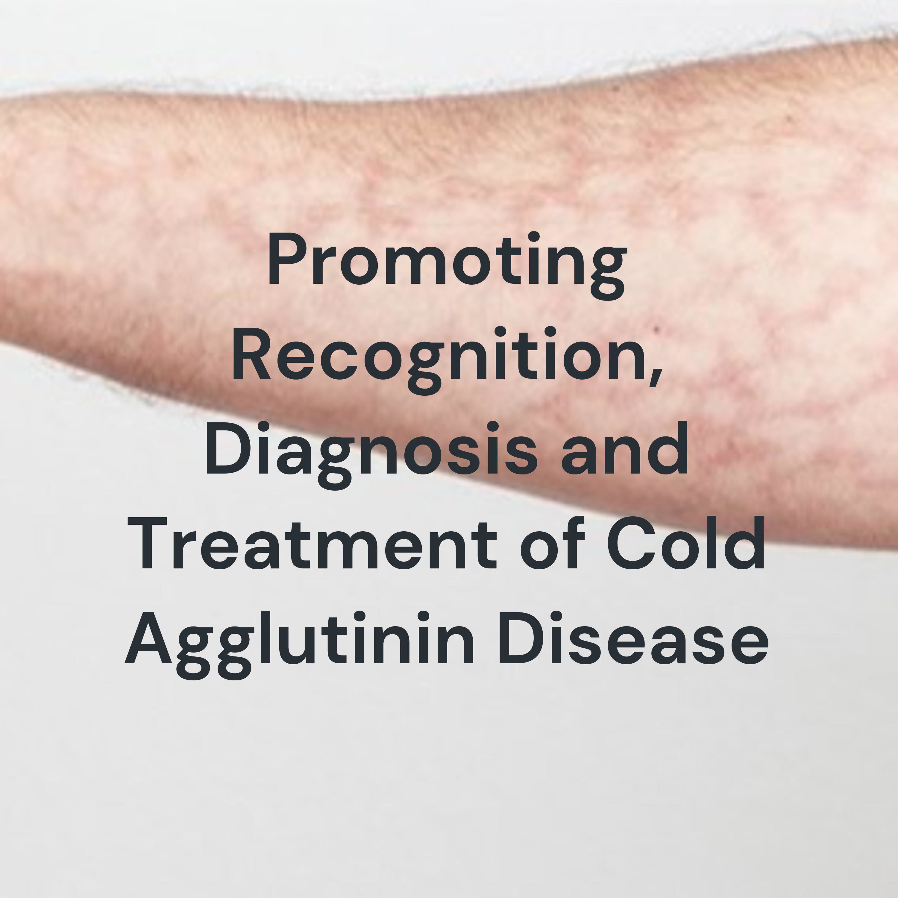 Current Treatment Approaches for Patients with Cold Agglutinin Disease ...