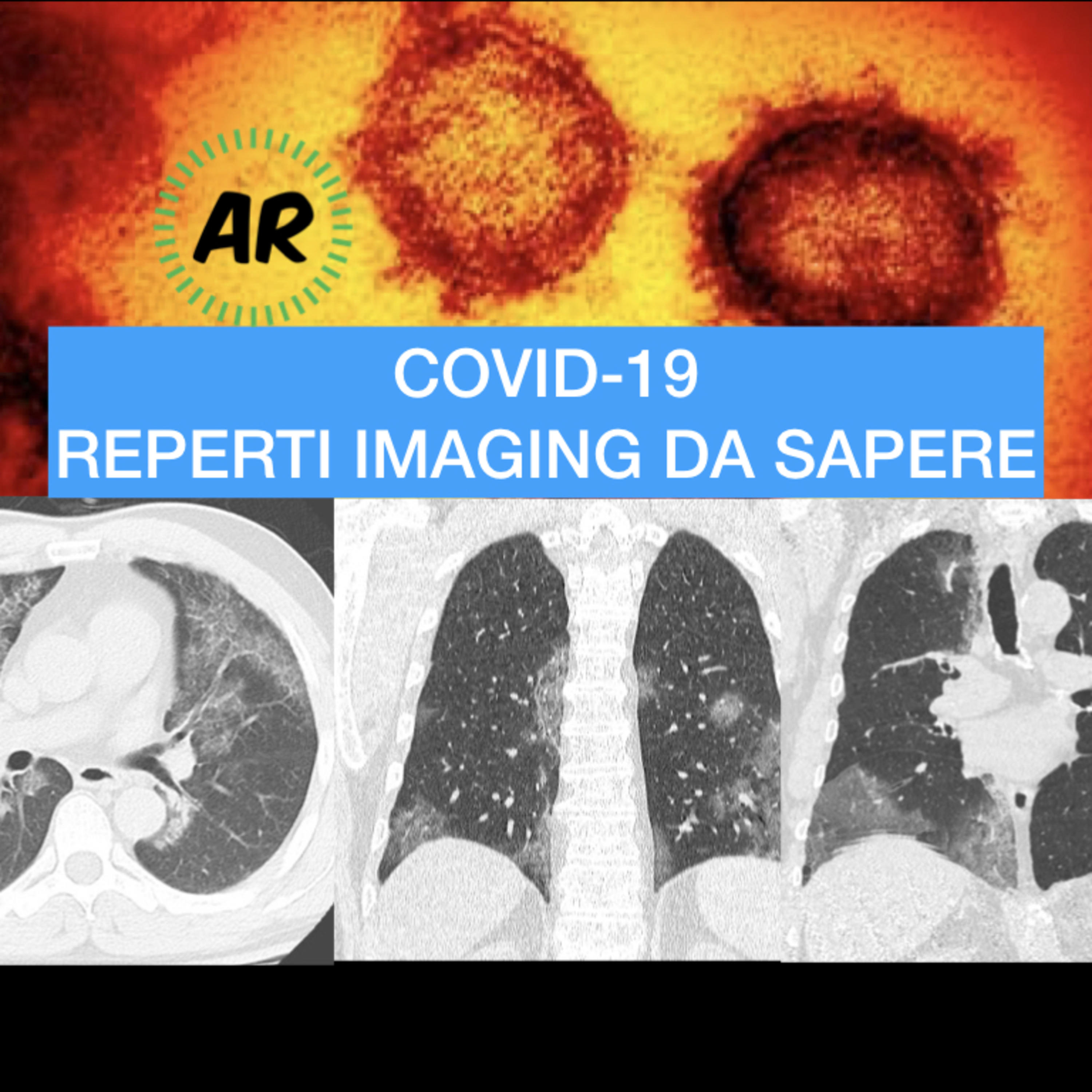 Appunti di Radiologia
