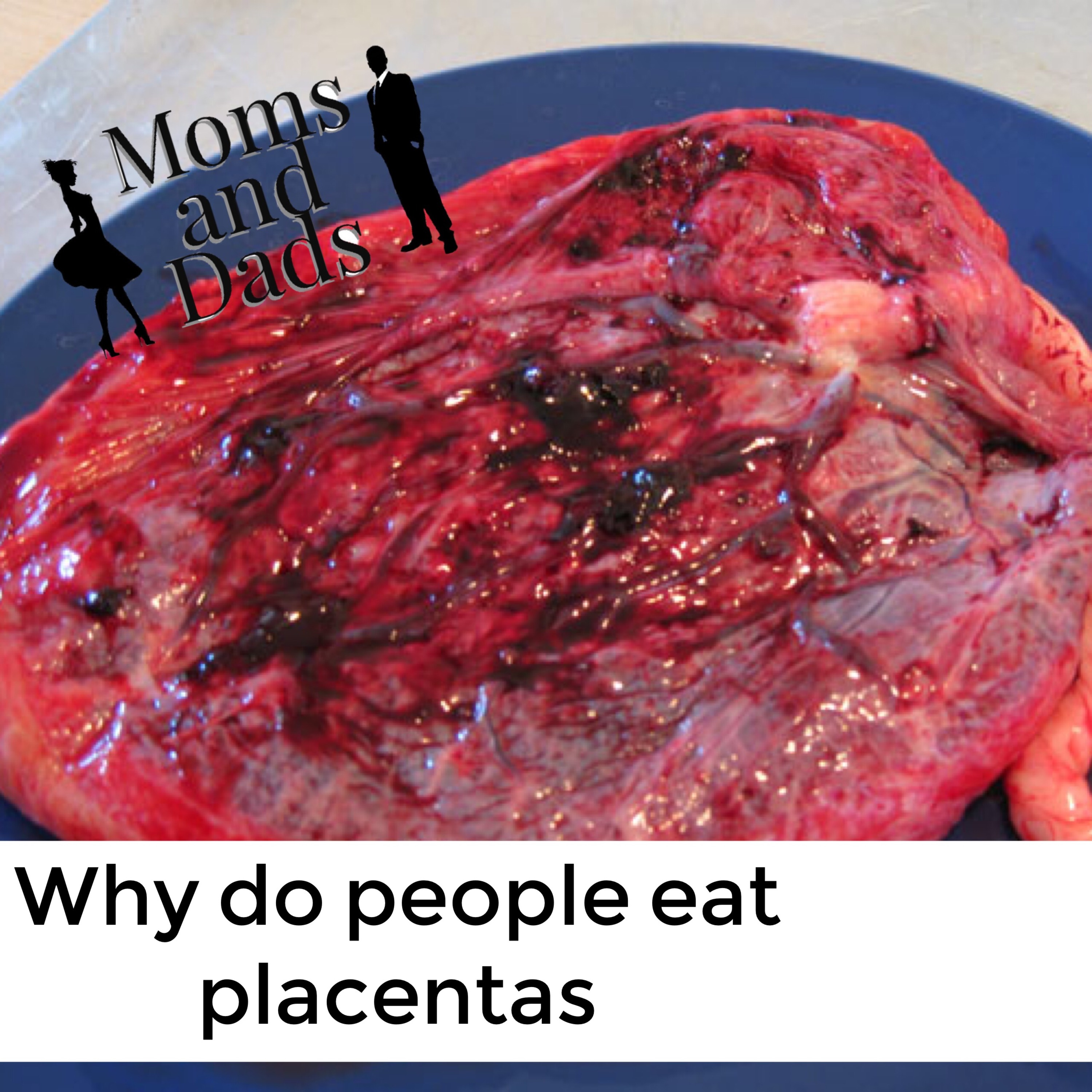 Why do people eat placentas, Tips for being a man episode artwork