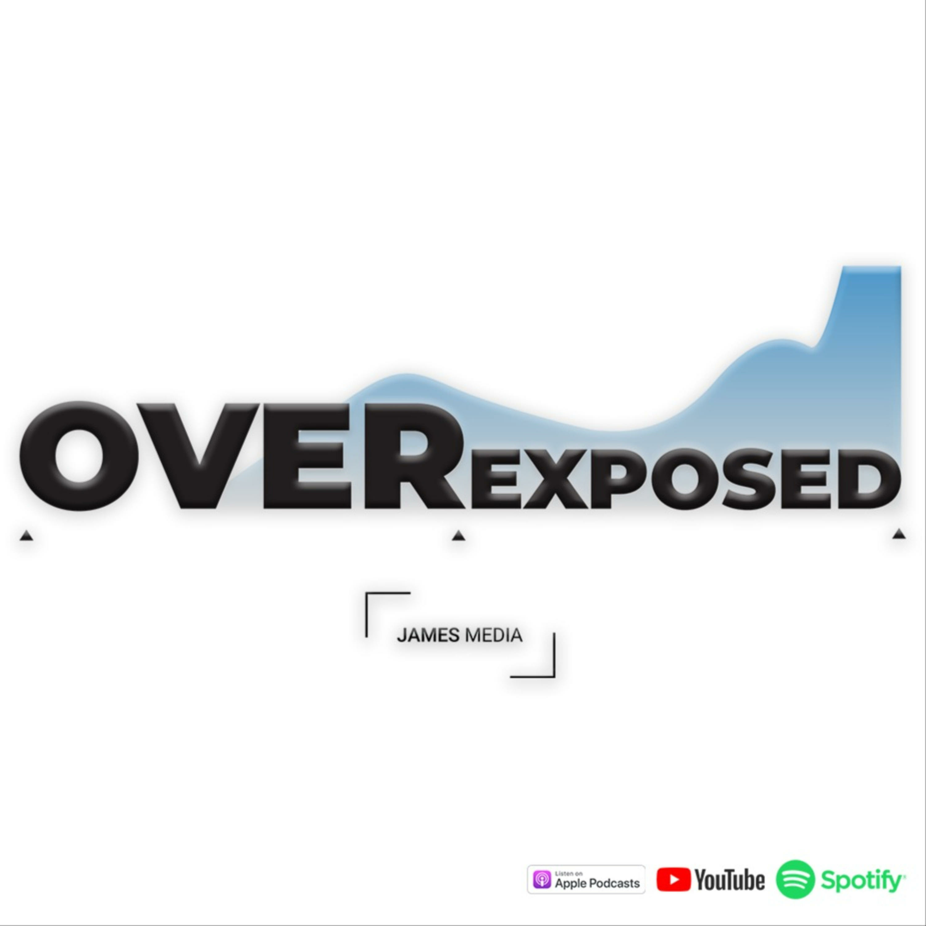 OVERexposed
