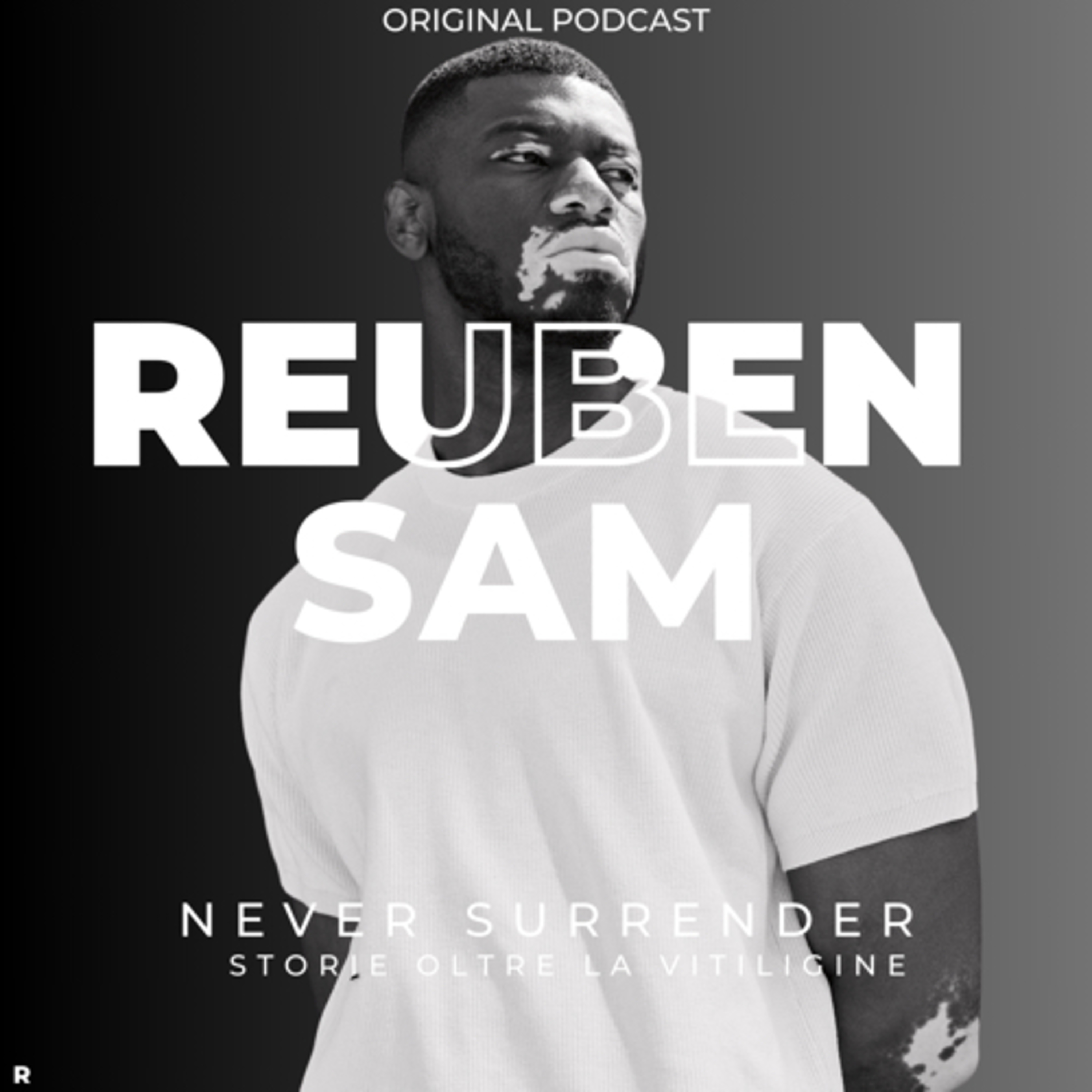 Never surrender - Storie oltre la vitiligine