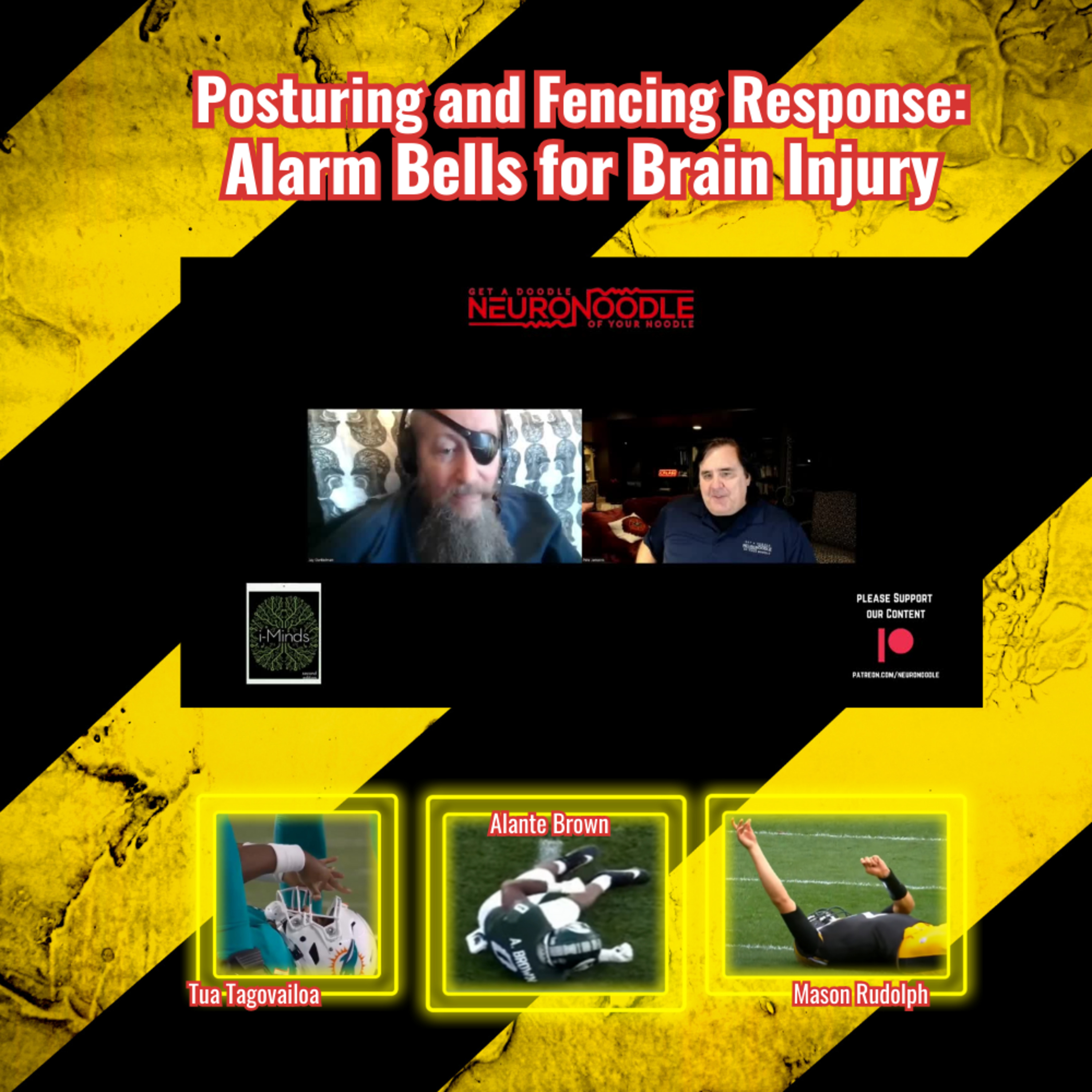 Posturing and Fencing Response Alarm Bells for Brain Injury