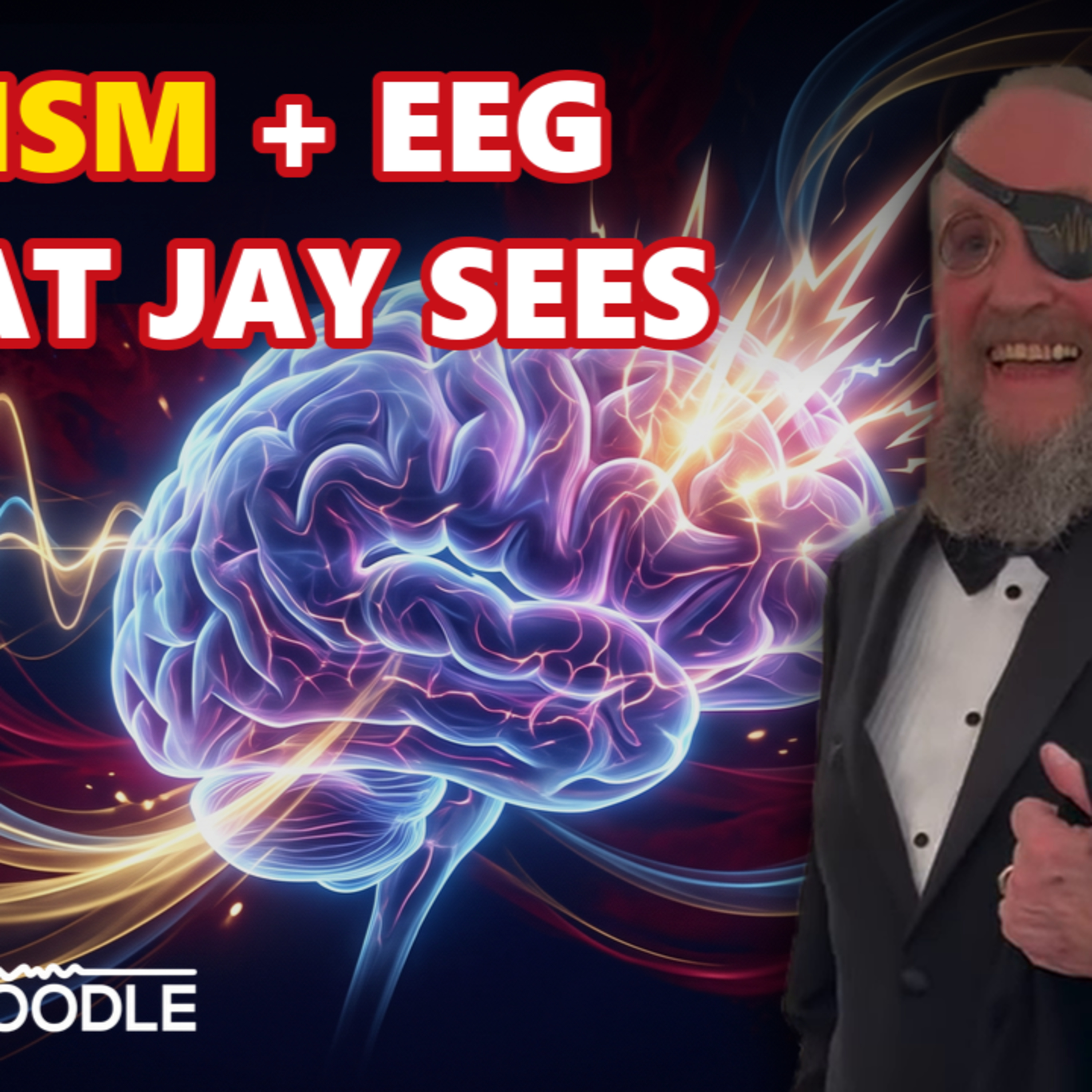 Hidden Epileptiform Activity in Autism? Jay Explains | NeuroNoodle Neurofeedback Therapy Podcast