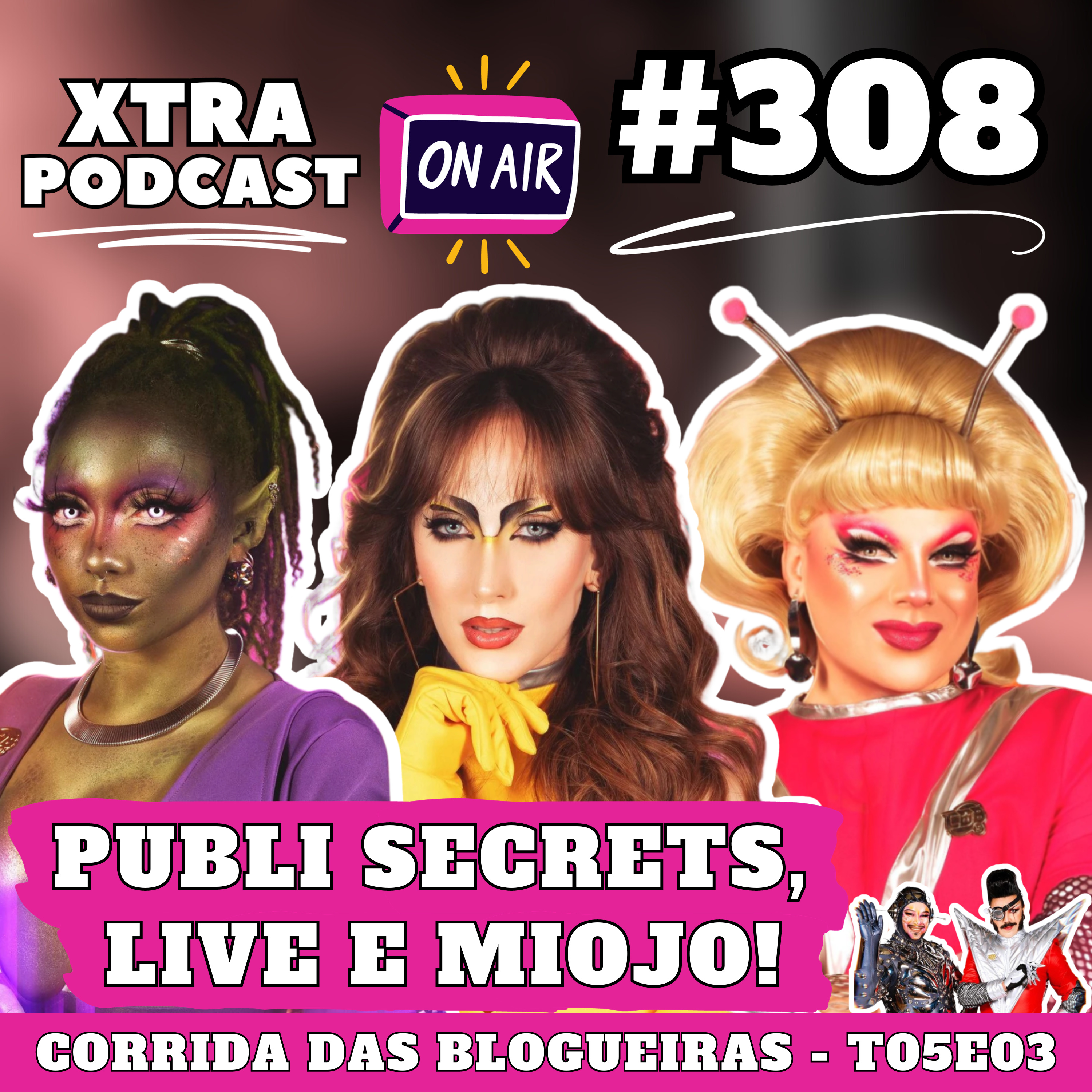 Xtra Podcast