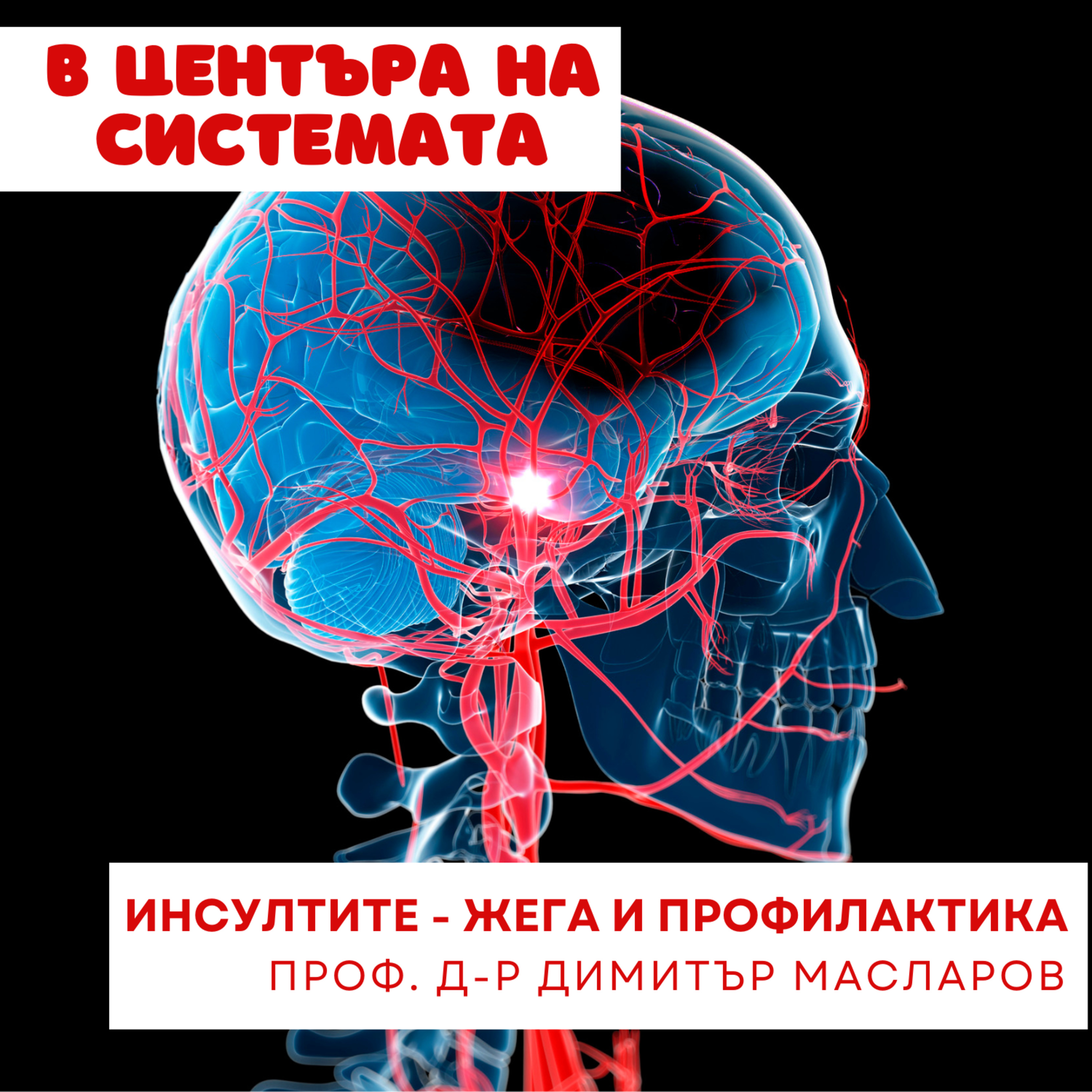 В центъра на системата - Първична профилактика на инсулта episode artwork