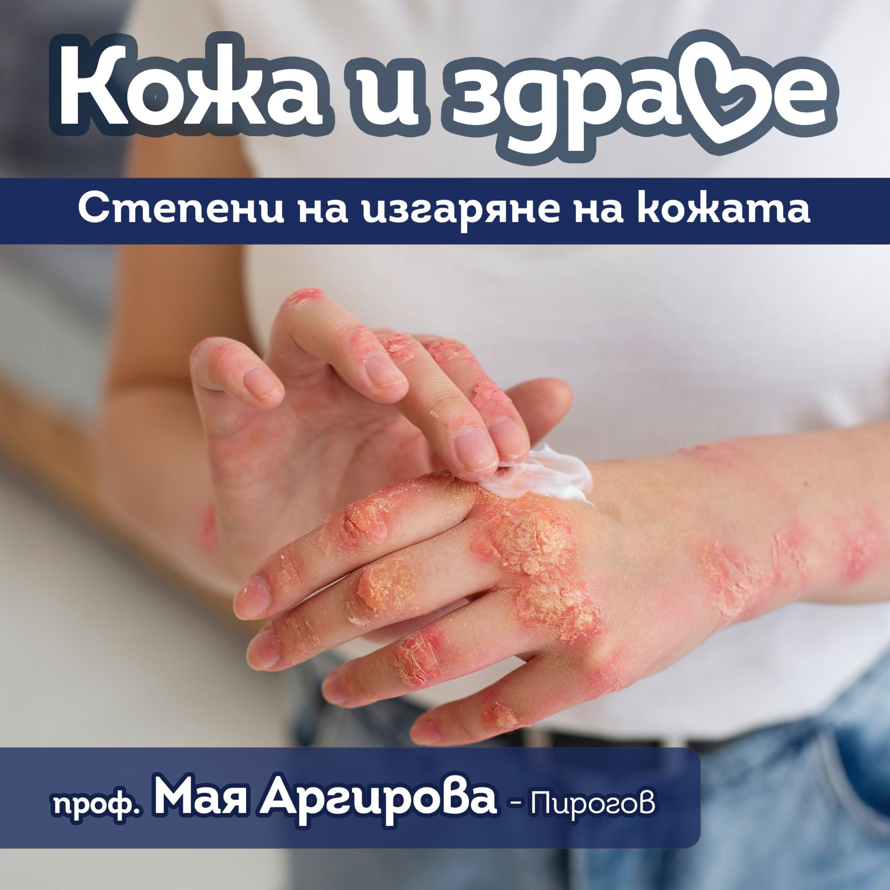 Кожа и здраве - Тежки изгаряния на кожата episode artwork