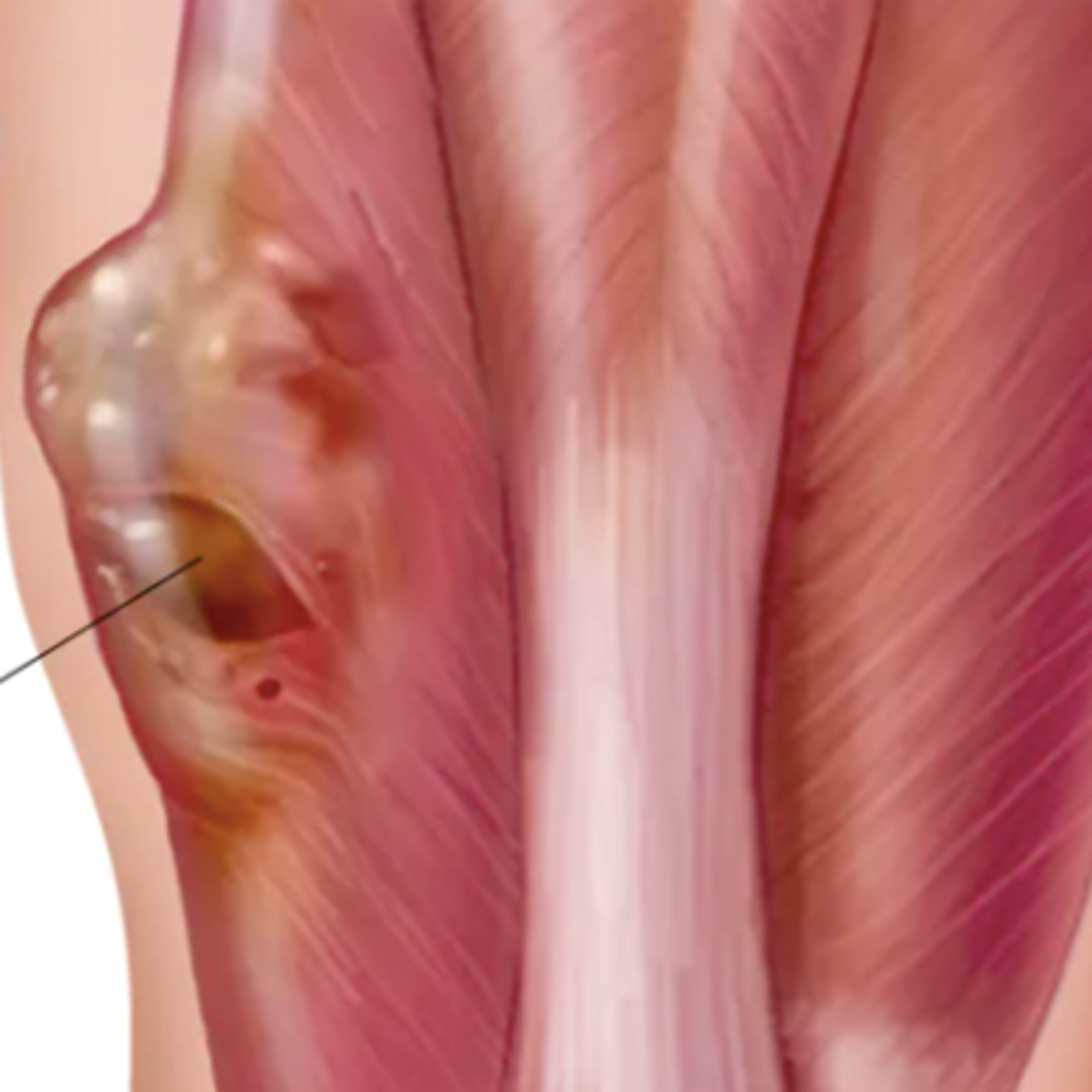 🔵 LA REMISIÓN DE UN CÁNCER - CASOS REALES - CON TESTIMONIO PERSONAL episode artwork