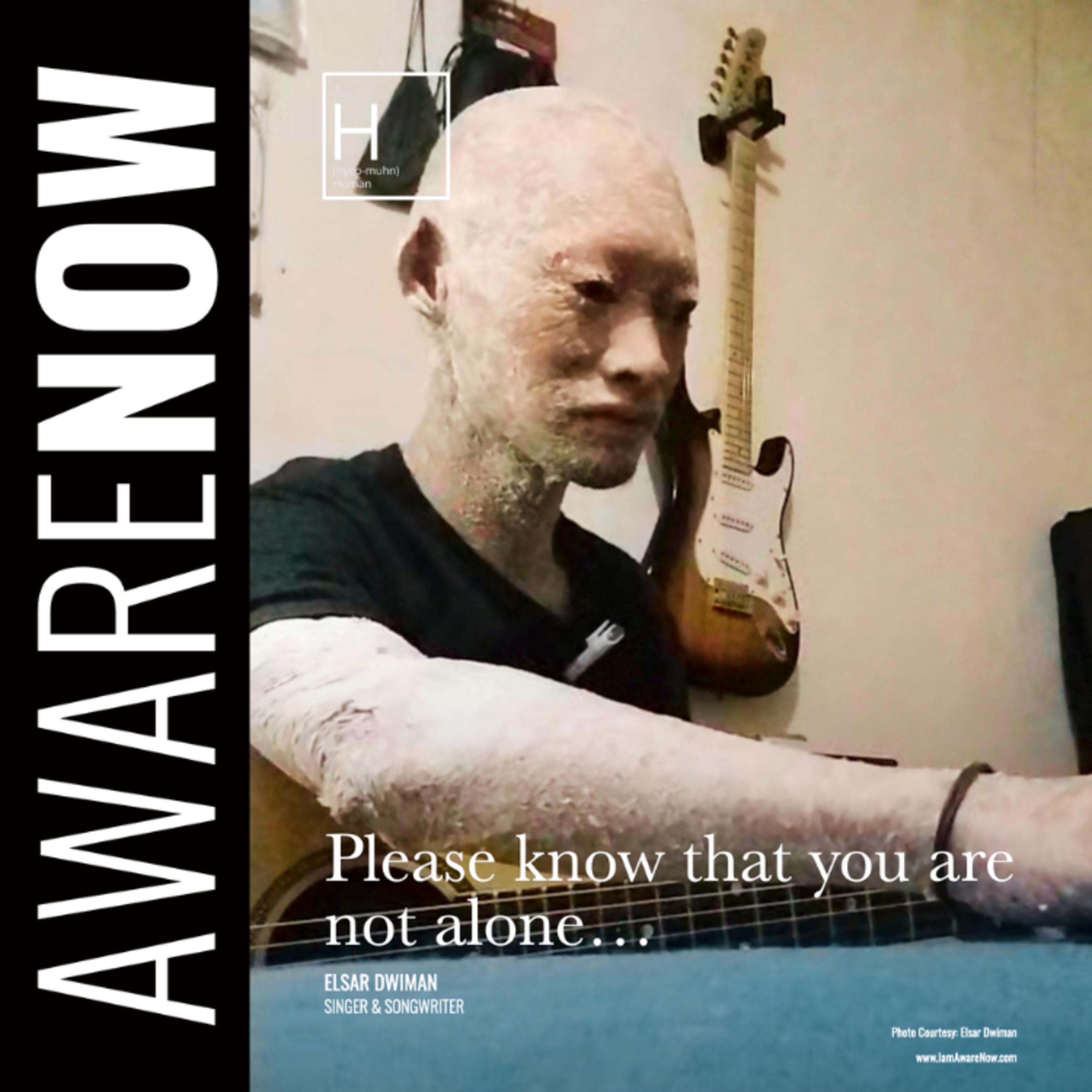 AwareNow 'Innerviews' w/Elsar Dwiman in 'Carry Your Pain'