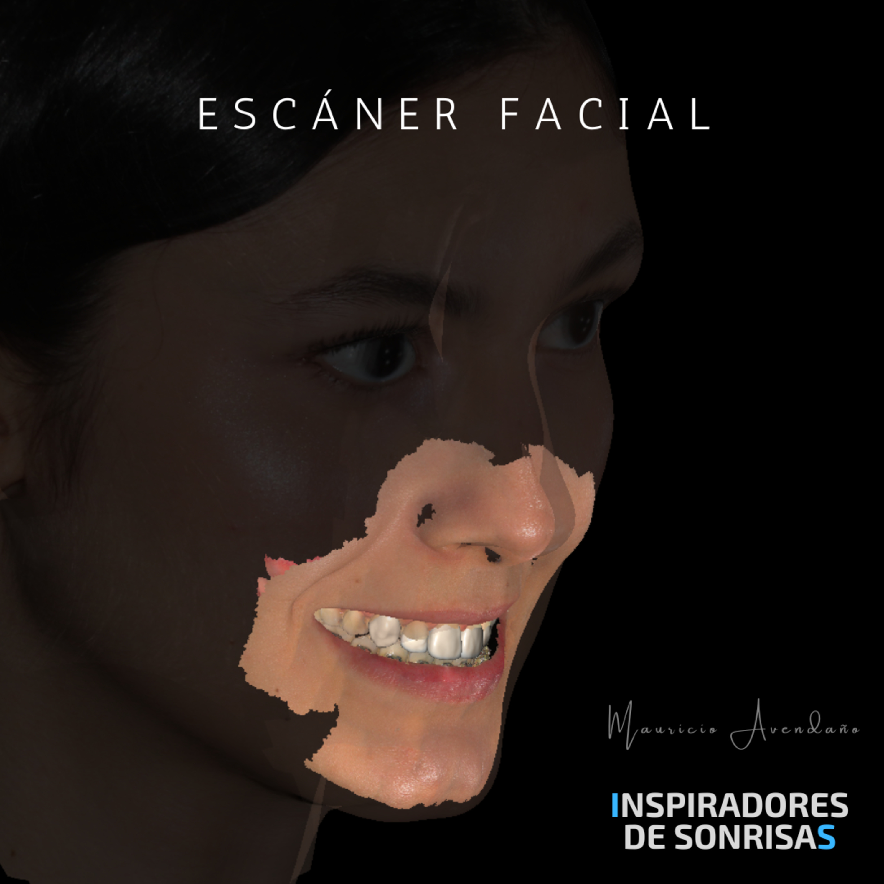 Odontología Digital con MAU