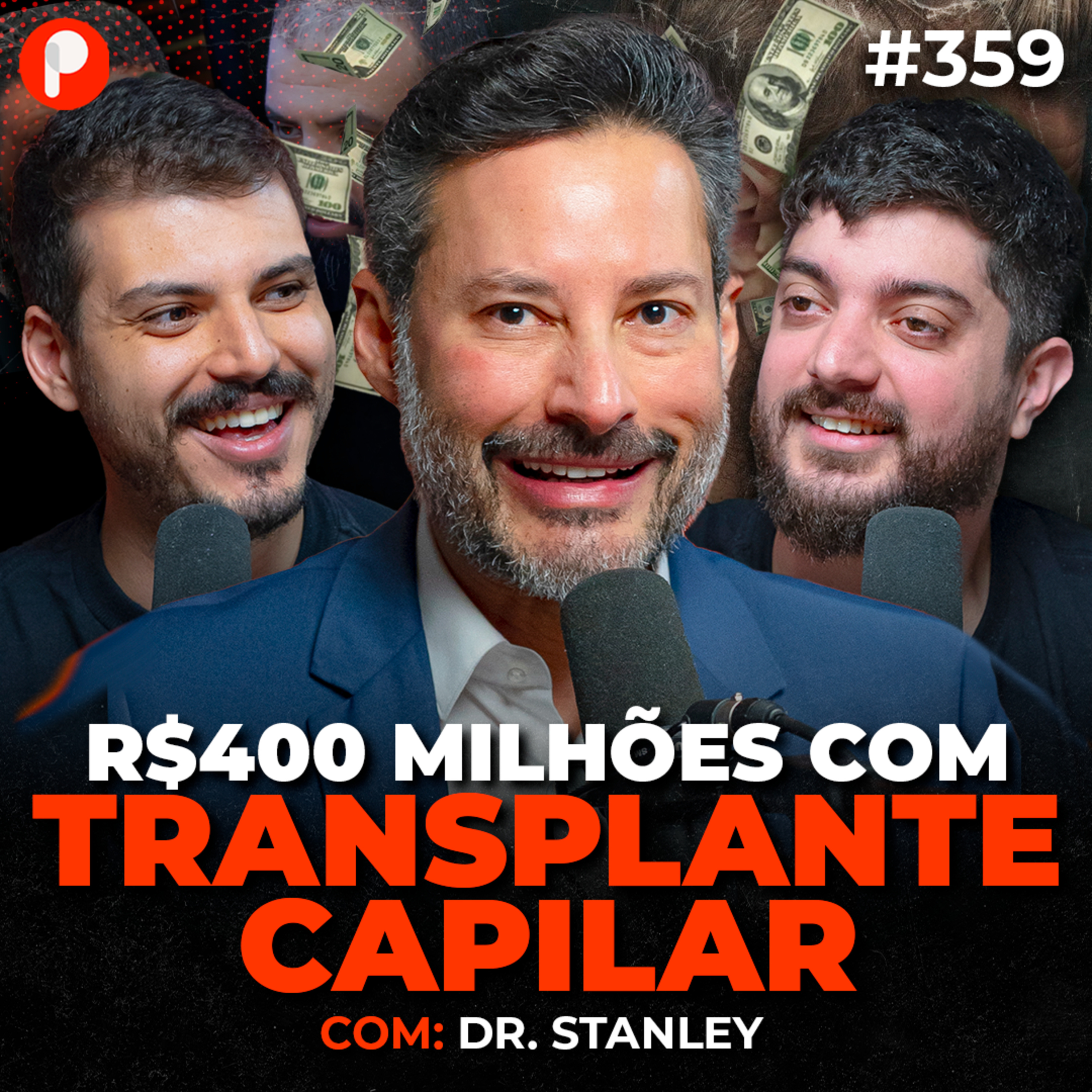PrimoCast 359 | COMO A STANLEY’S HAIR FAZ R$400 MILHÕES COM TRANSPLANTE CAPILAR