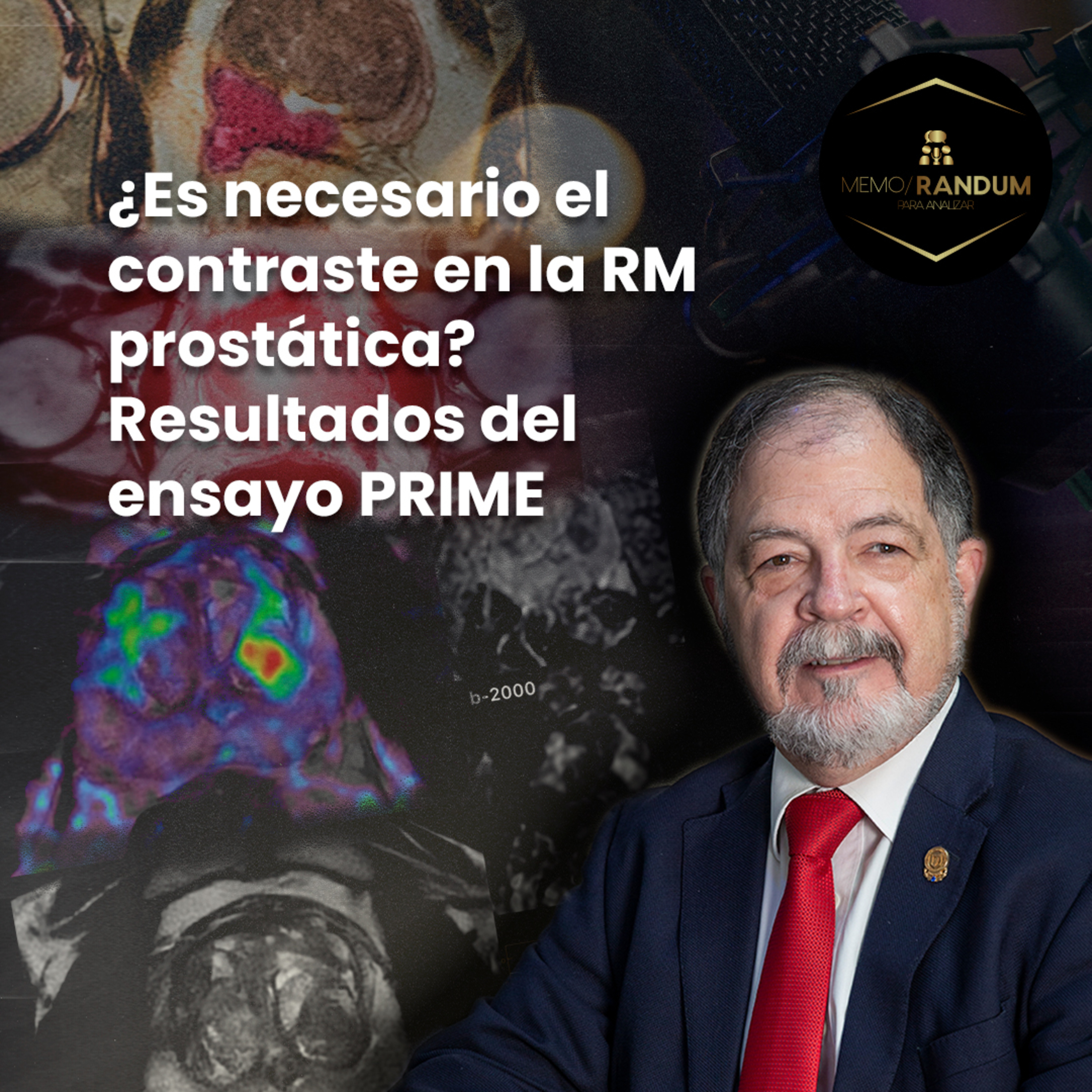 ¿Es necesario el contraste en la RM prostática? Resultados del ensayo PRIME.