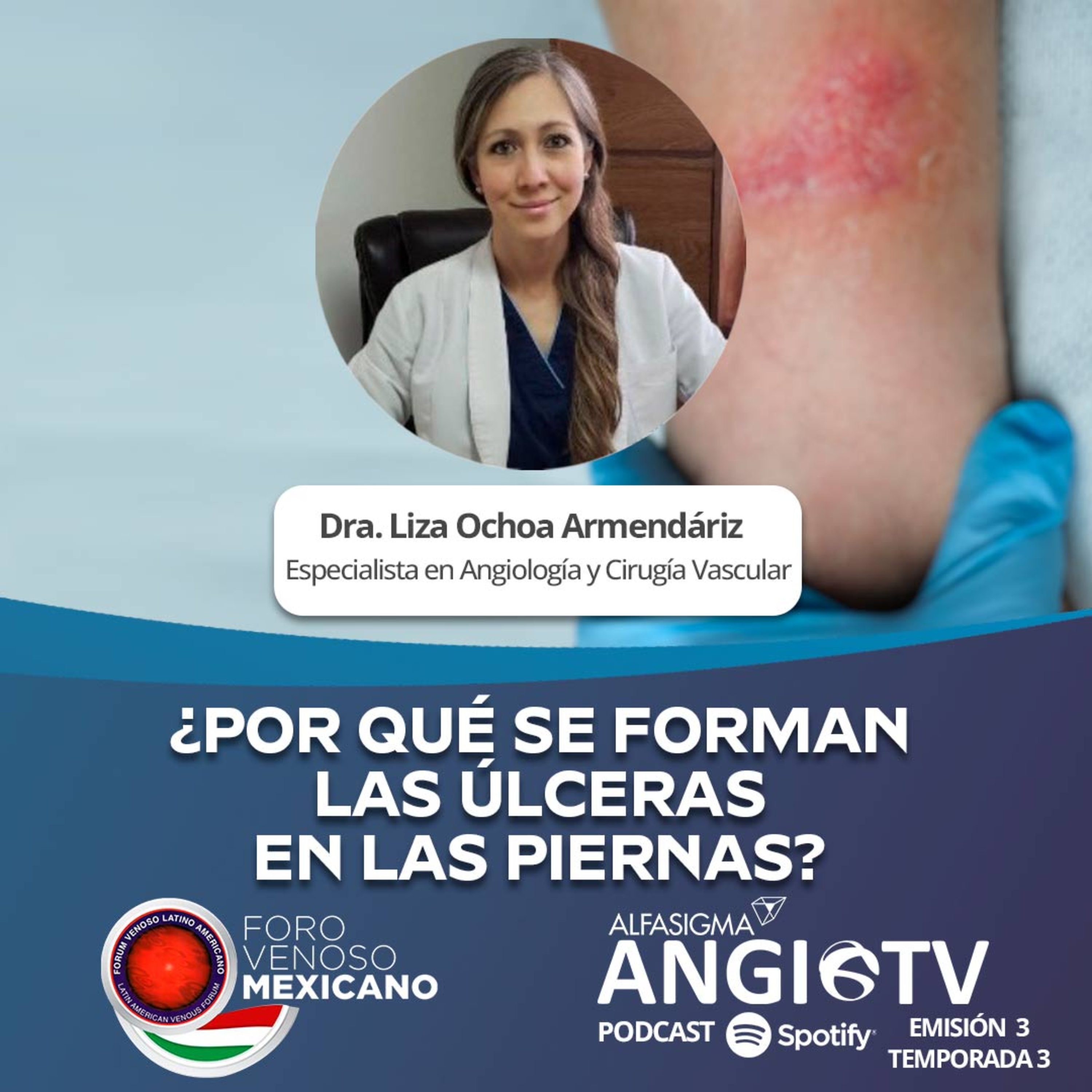 ANGIO TV