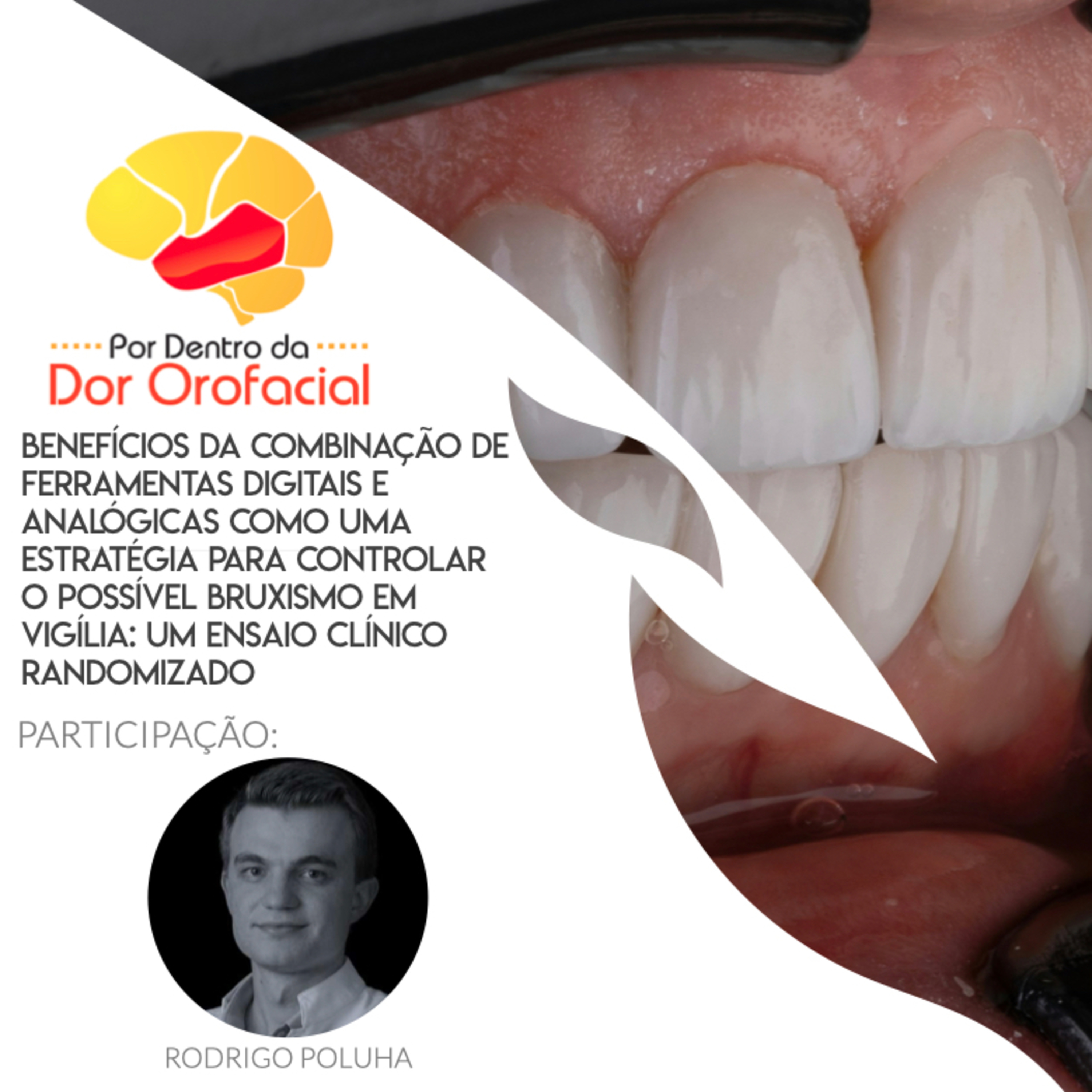 Benefícios da combinação de ferramentas digitais e analógicas na terapia do Bruxismo em Vigília