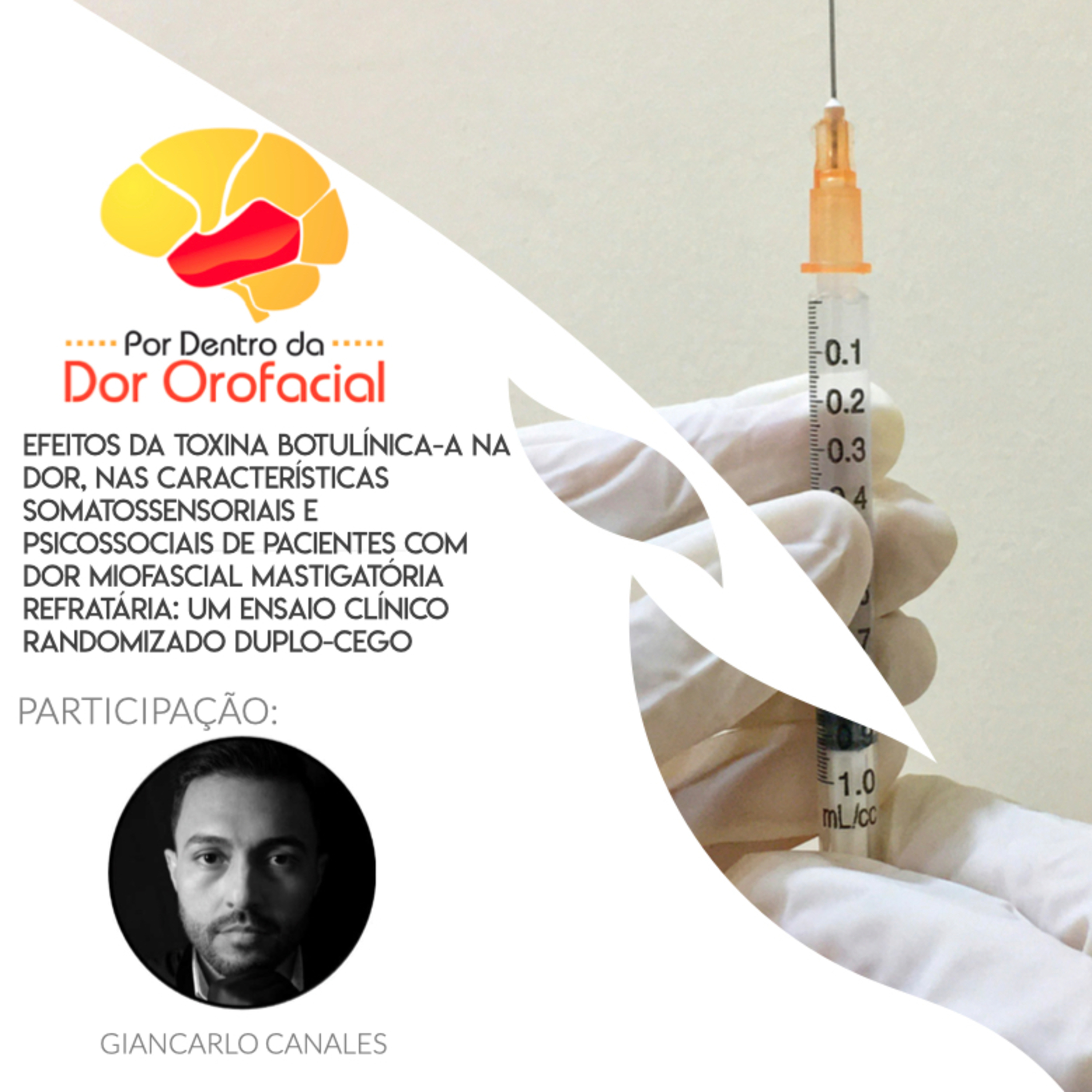 Toxina botulínica e seu uso em pacientes com DTM muscular refratários a terapia conservadora