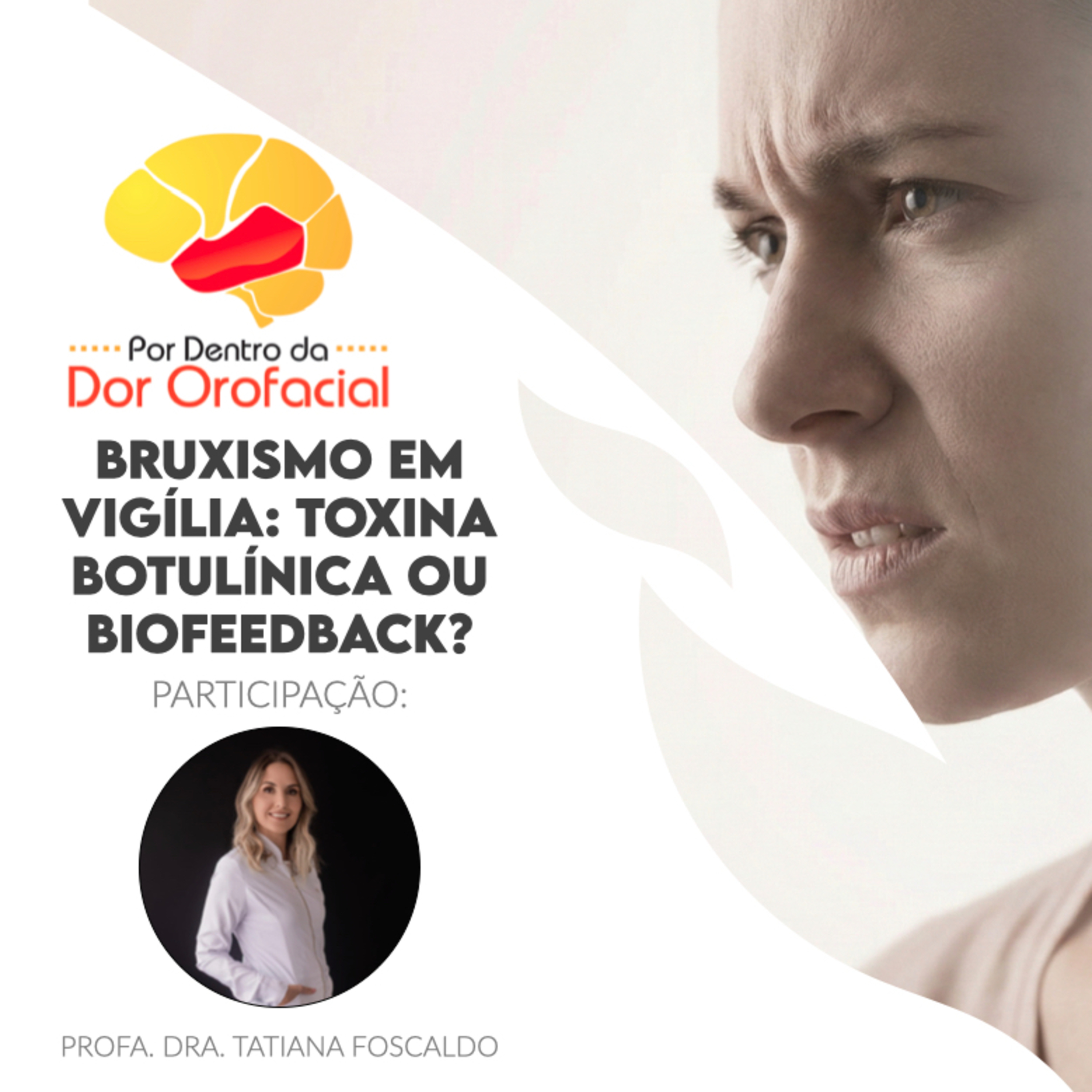 Bruxismo em Vigília: Toxina Botulínica ou Biofeedback?