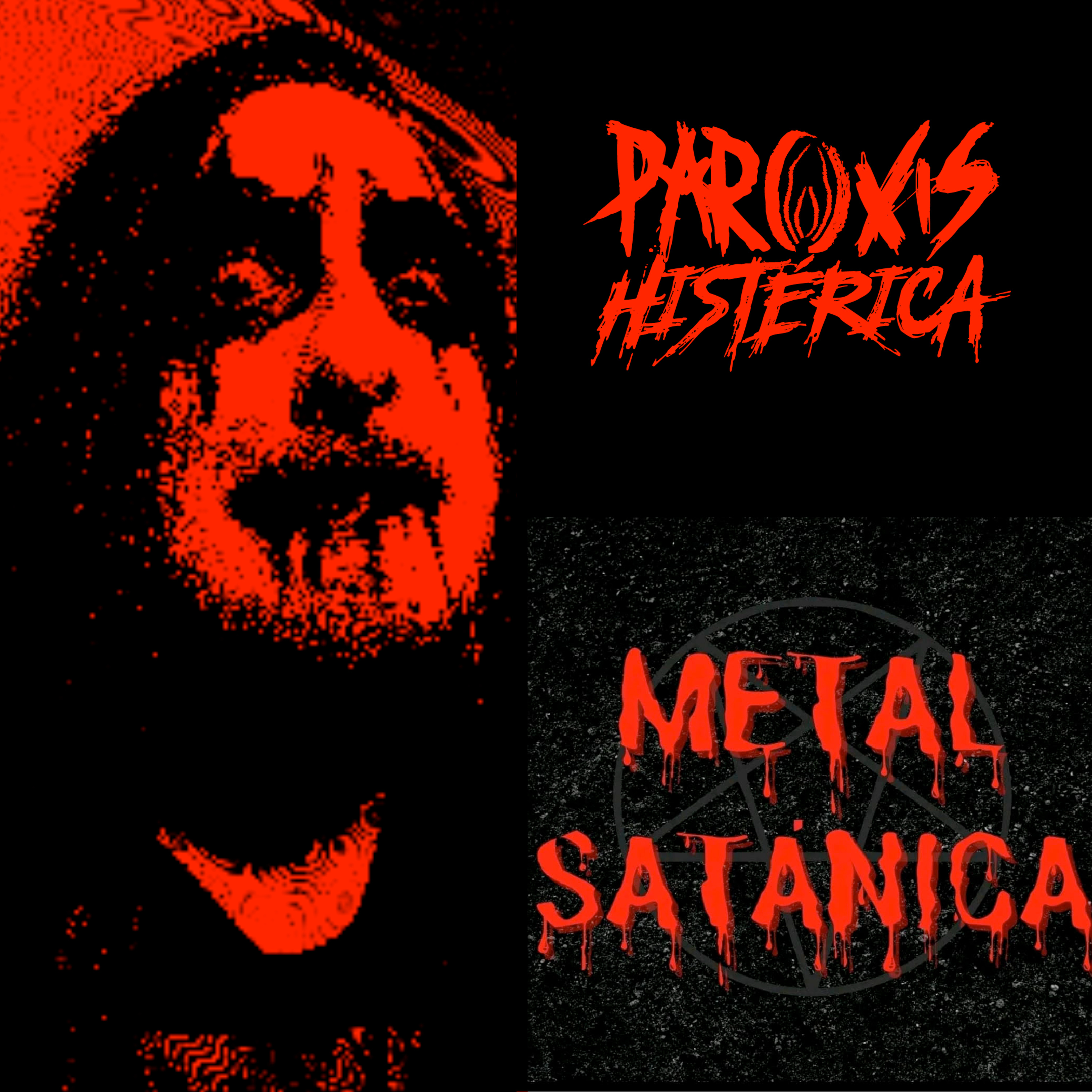 Paroxis Histérica
