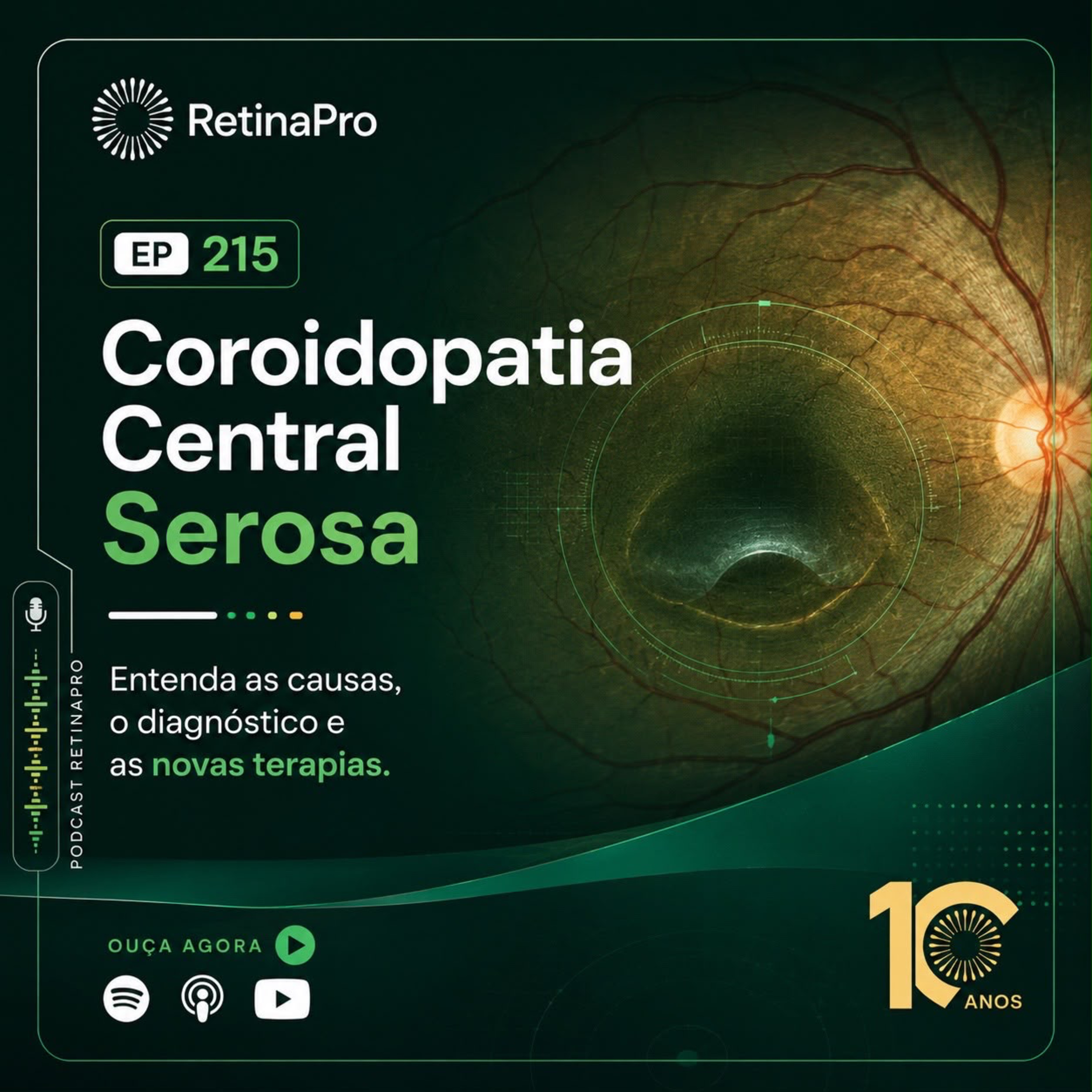 Coroidopatia Central Serosa - Entenda as causas, o diagnóstico e as novas terapias #215 episode artwork