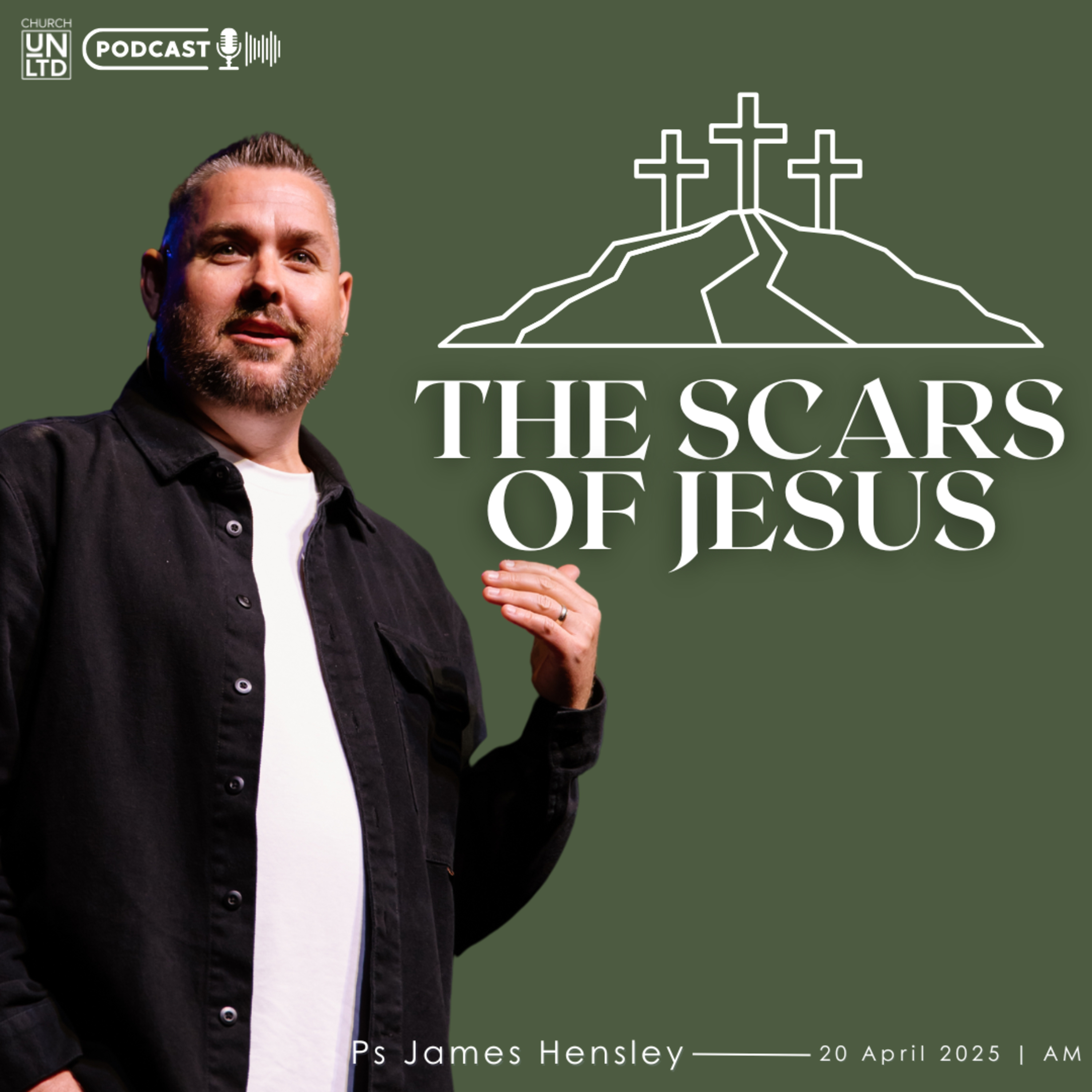 The Scars of Jesus with Ps. James Hensley | 20 4 2025 | Resurrection Sunday episode artwork