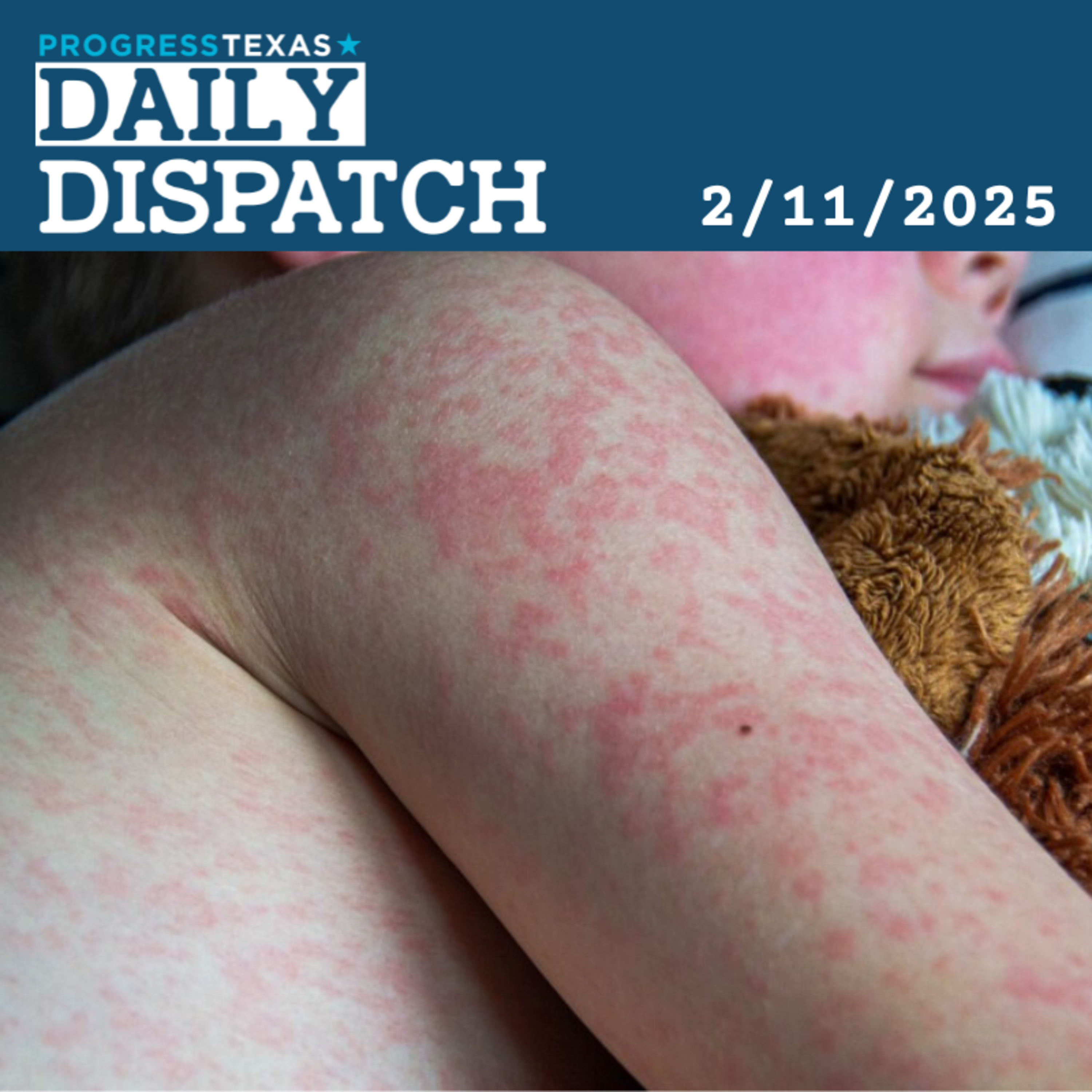 Daily Dispatch 2/11/25: Measles Outbreak Gains Steam, Concerning State Health Officials, and More episode artwork
