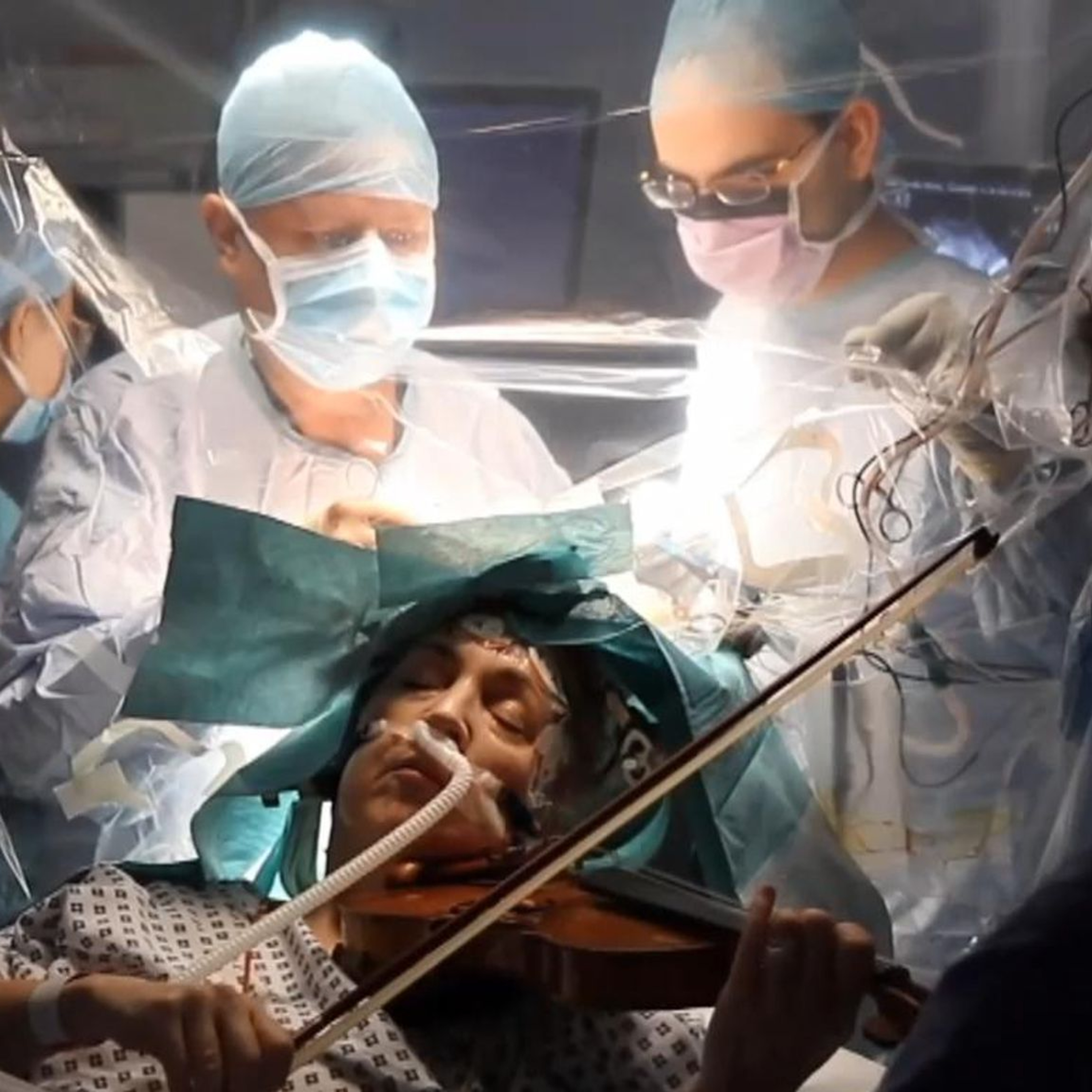 Awake but Asleep : The Brain Surgery That Talks Back episode artwork