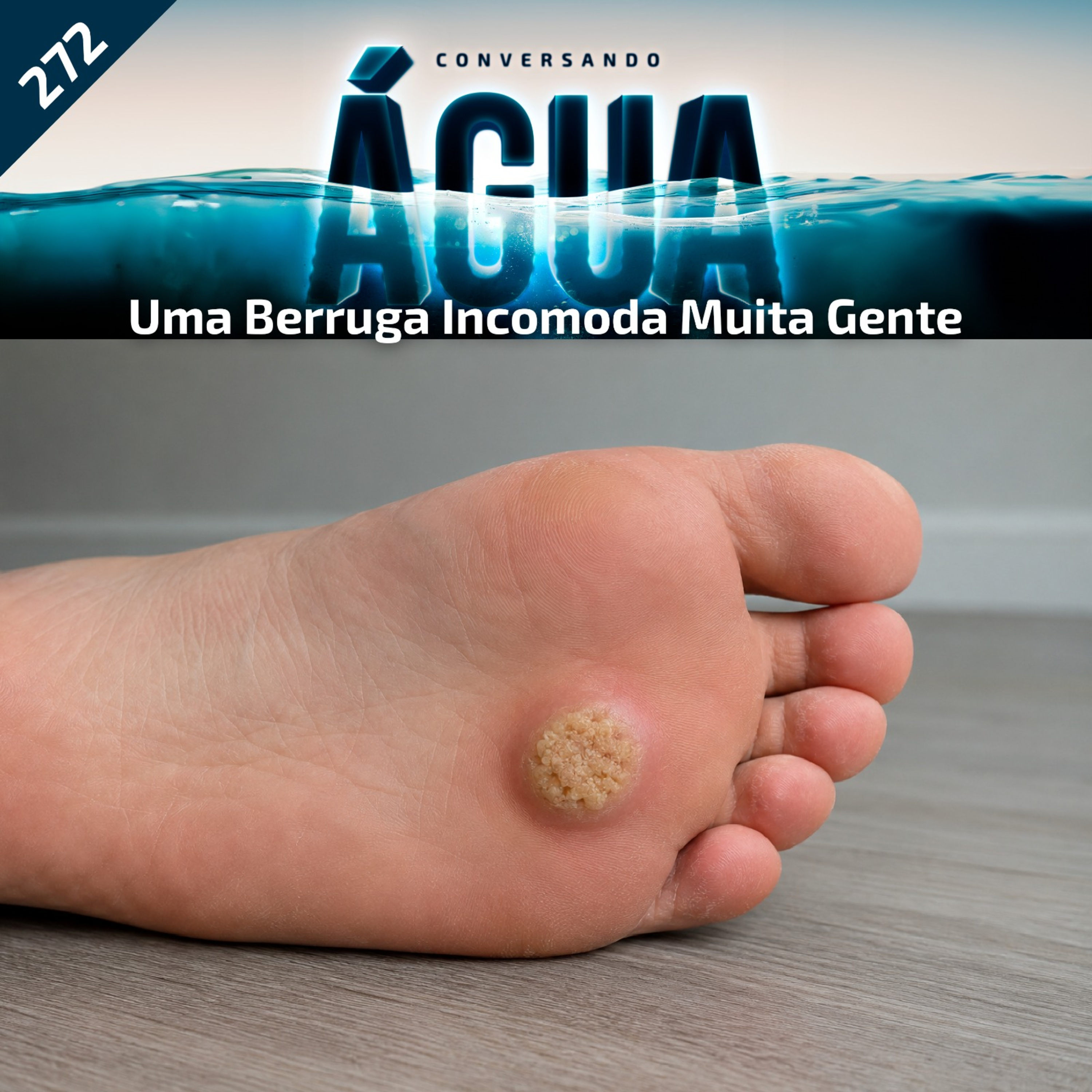 EP 272 - Uma berruga incomoda muita gente. episode artwork